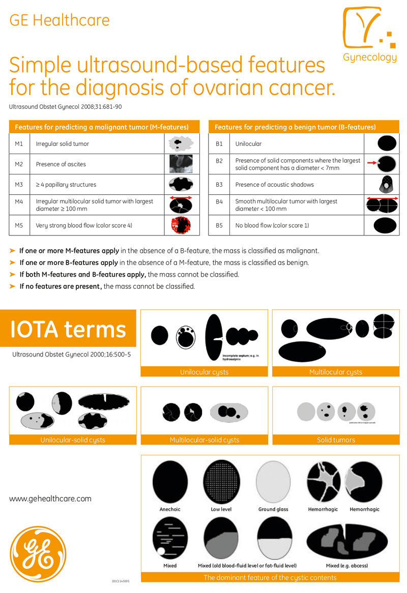 ge ultrasound poster iota simple rules